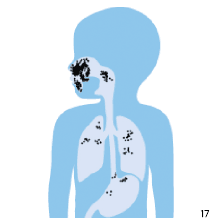 Maske med en d&aring;rlig t&aelig;tning