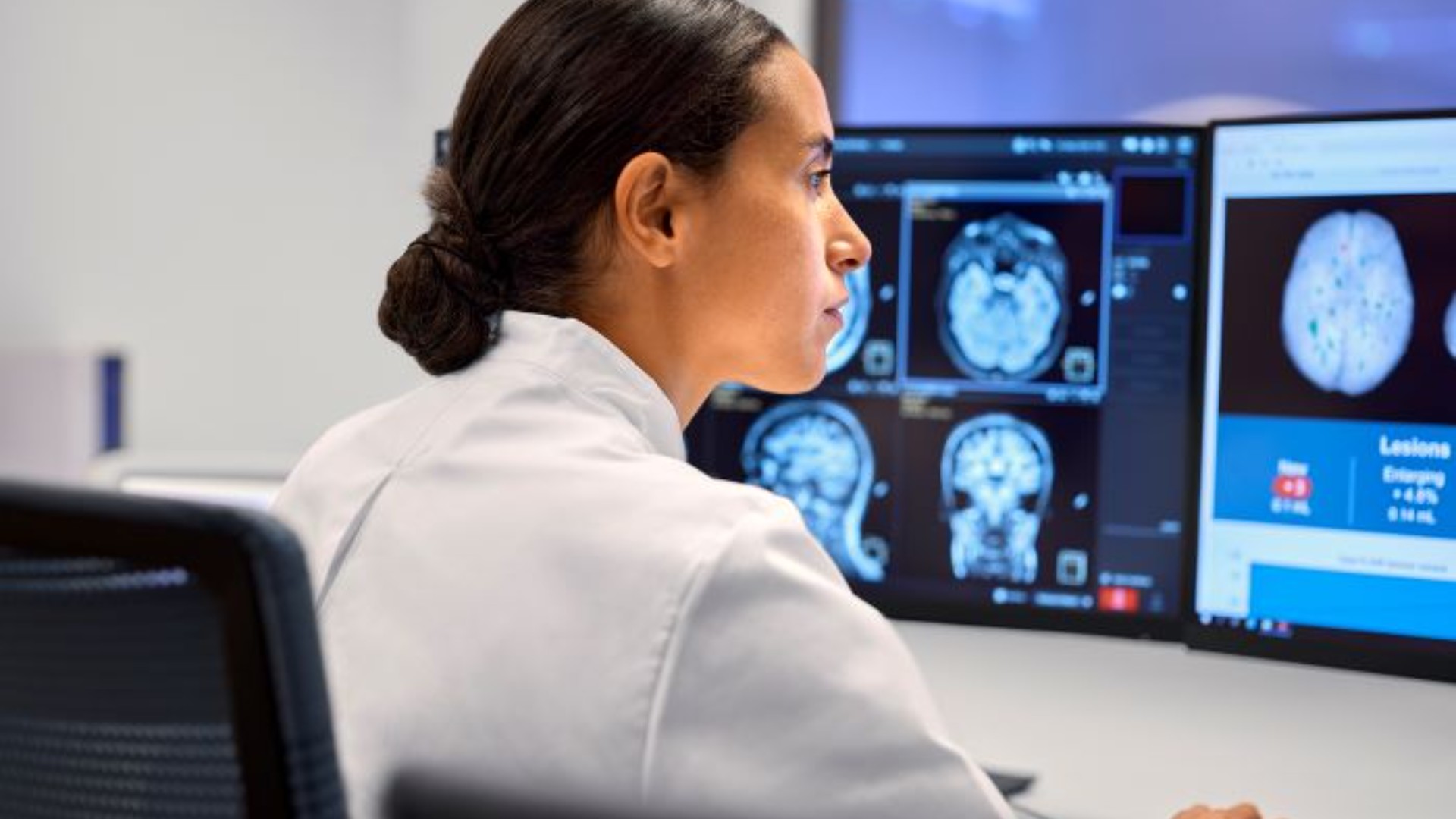 Philips AI Manager Now Available Nationwide in Norway